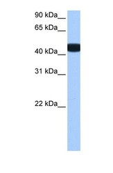 NBP1-57574 - BCKDK