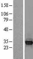 NBL1-07955 - BCL7C Lysate