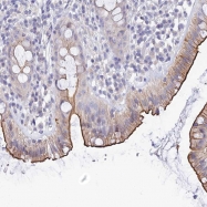NBP1-91698 - BCMO1