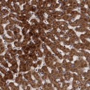 NBP1-88677 - BCS1L / BCS1