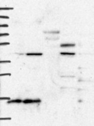 NBP1-88677 - BCS1L / BCS1