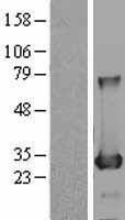 NBL1-07958 - BDH2 Lysate