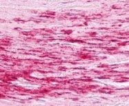 NLS799 - BDKRB1