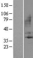 NBL1-07959 - BDKRB1 Lysate