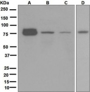 NBP1-95843 - BDKRB2