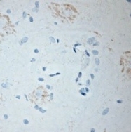 NBP1-46328 - BDKRB2