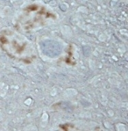NBP1-46328 - BDKRB2