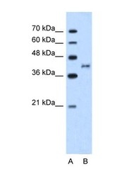 NBP1-59044 - BDKRB2