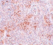 NBP1-77111 - BFAR / RNF47