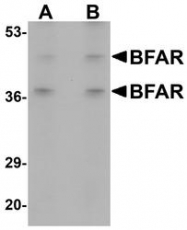 NBP1-77111 - BFAR / RNF47