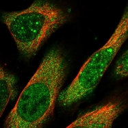 NBP1-88640 - Bleomycin hydrolase