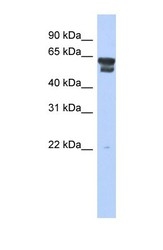 NBP1-55141 - Bleomycin hydrolase