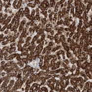 NBP1-89958 - ZMYND10