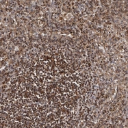 NBP1-86105 - BMP10
