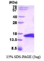 NBP1-30182 - BMP5