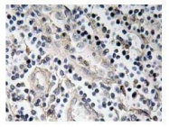 NBP1-51257 - BMP7