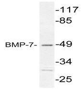 NBP1-51257 - BMP7