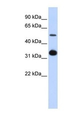 NBP1-59308 - BMP9