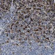 NBP1-88572 - BMPR2