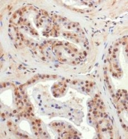 NBP1-78264 - BNIP3L / BNIP3A