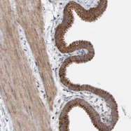 NBP1-88556 - BNIPL
