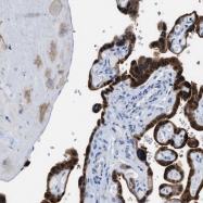 NBP1-86064 - Bisphosphoglycerate mutase
