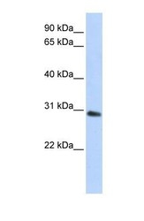 NBP1-53186 - Bisphosphoglycerate mutase
