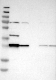 NBP1-86064 - Bisphosphoglycerate mutase
