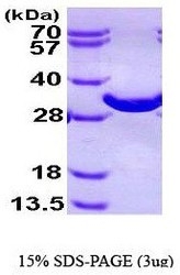 NBP1-44485 - Bisphosphoglycerate mutase