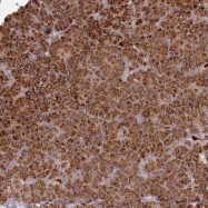 NBP1-90753 - BPIL2