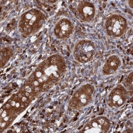NBP1-88372 - BPIL3