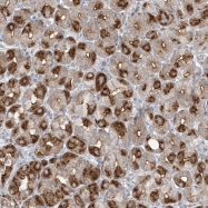 NBP1-89943 - ABTB1
