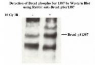 NB100-225 - BRCA1 / RNF53
