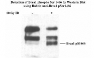 NB100-228 - BRCA1 / RNF53
