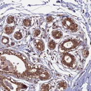 NBP1-88550 - BRCA1 / RNF53