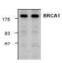 NBP1-45410 - BRCA1 / RNF53