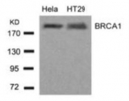 NB100-81826 - BRCA1 / RNF53