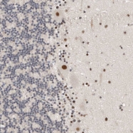 NBP1-88361 - BRCA2 / FANCD1