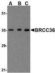 NBP1-76831 - BRCC3