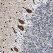 NBP1-86640 - BRD4