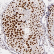 NBP1-82457 - BRD8