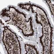 NBP1-88357 - BRD6 / BRDT