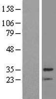 NBL1-08028 - BRMS1 Lysate