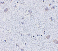 NBP1-77280 - BRSK1