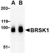 NBP1-76778 - BRSK1