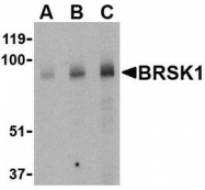 NBP1-77280 - BRSK1