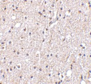 NBP1-77281 - BRSK2