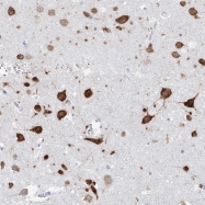 NBP1-89932 - BRUNOL4 / CELF4