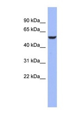 NBP1-57320 - BRUNOL4 / CELF4