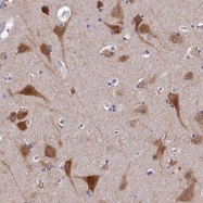 NBP1-89931 - BRUNOL5 / CELF5